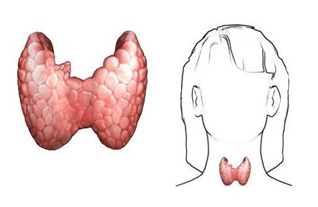 女性には甲状腺疾患の徴候がある