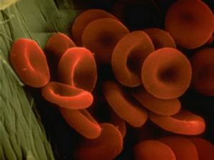 女性の血液中のヘモグロビンの基準